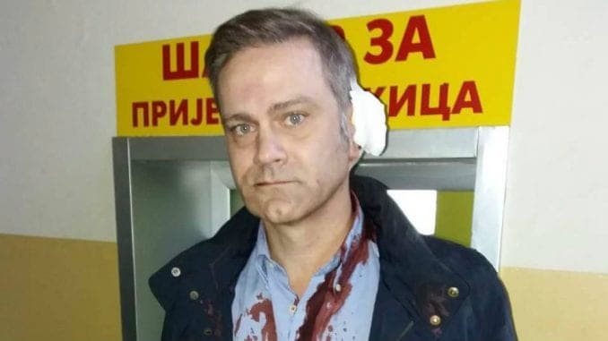 Ukinut pritvor osumnjičenima za napad na Borka Stefanovića