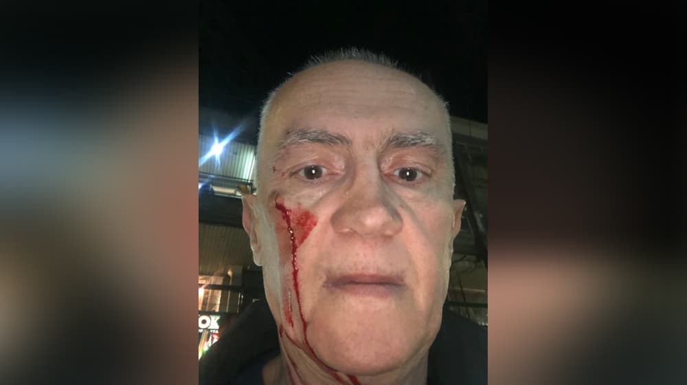 Rodoljub Šabić napadnut na ulici!