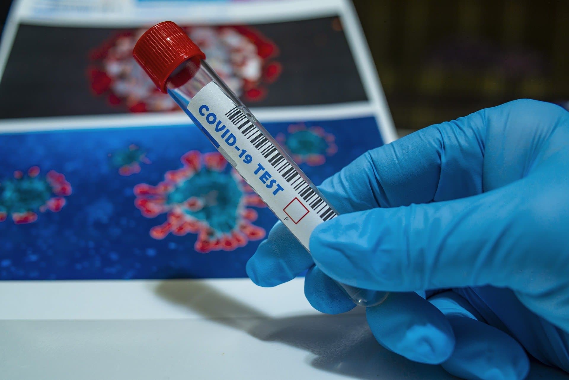 Čačak: Svi uzorci od vikenda negativni na korona virus
